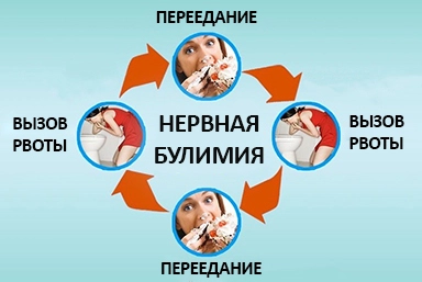 Лечение булимии в Саянске